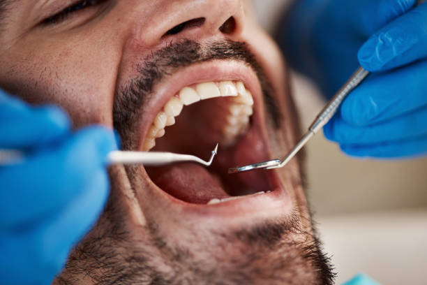 Best Broken Tooth Emergency  in Saddle River, NJ