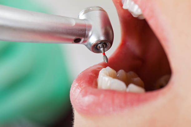 Best Emergency Dental Filling Replacement  in Saddle River, NJ